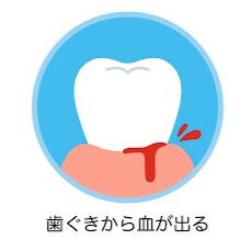 歯茎の出血