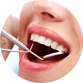 健康的な口腔環境を維持するためのメンテナンス